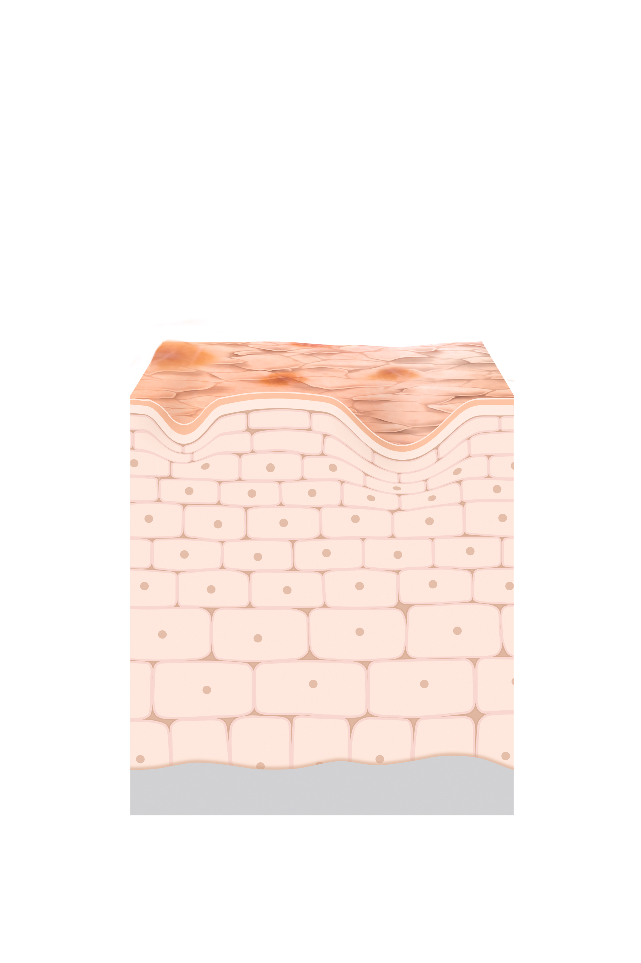 Skin insight